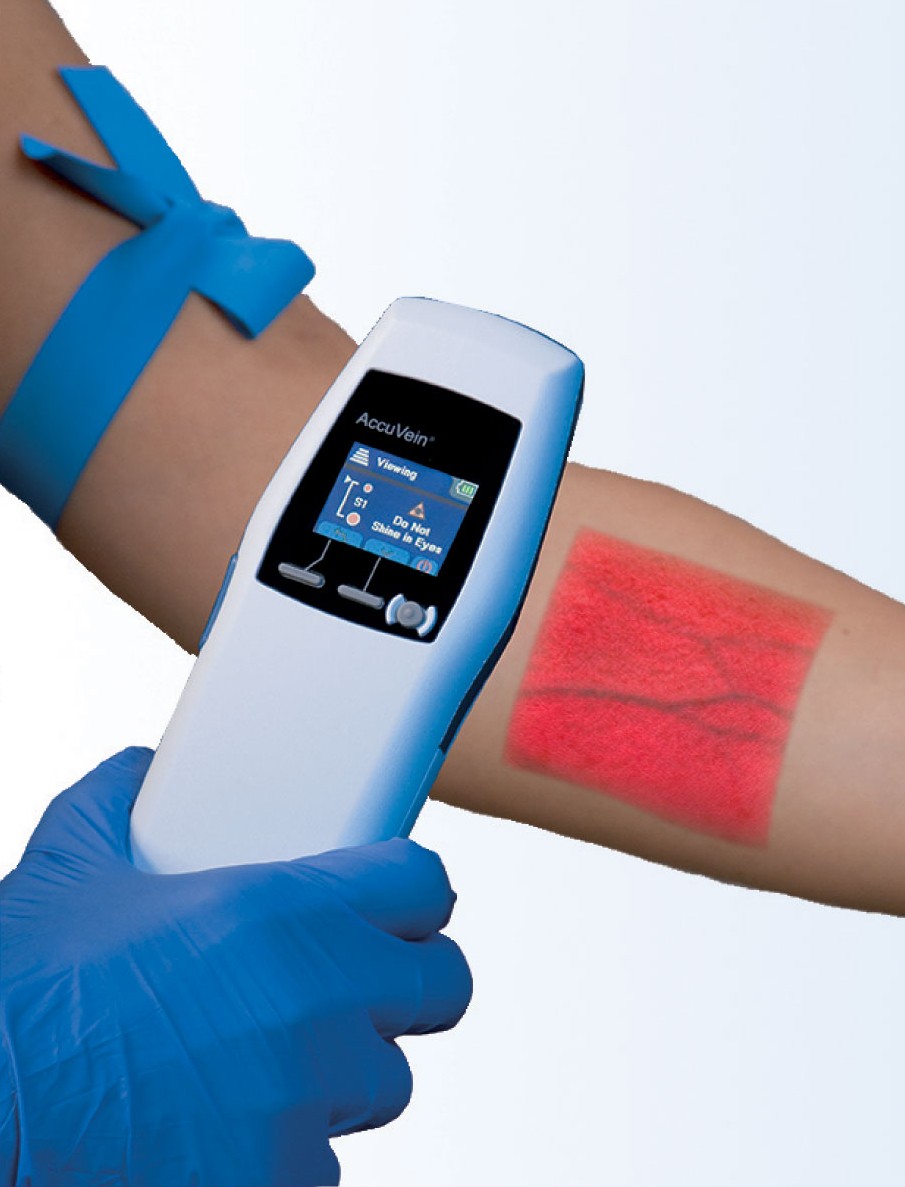 The Accuvein device depicting the visualisation of veins in the arm.