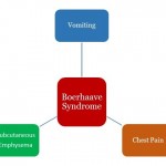 Boerhaave Syndrome